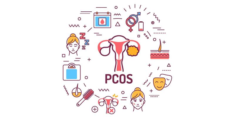 Διαγράμματα και σύμβολα σχετικά με τις πολυκυστικές ωοθήκες, με επισημάνσεις για την υγεία της γυναίκας